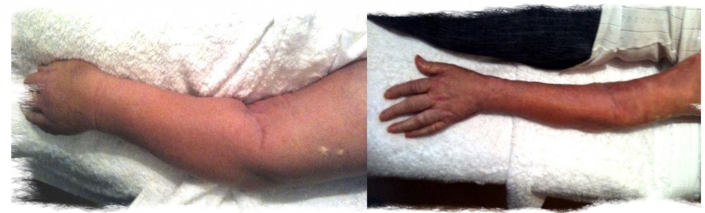 Armcomparison